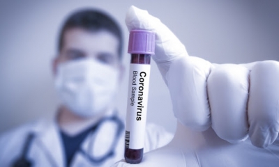 Se registraron dos nuevos casos de Covid – 19 en Baigorria