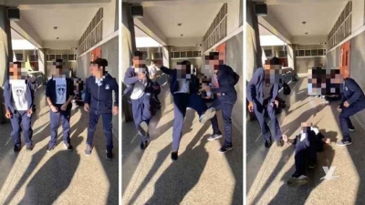 Pibe de Baigorria resultó fracturado al ser víctima del reto “Rompe Cráneo”