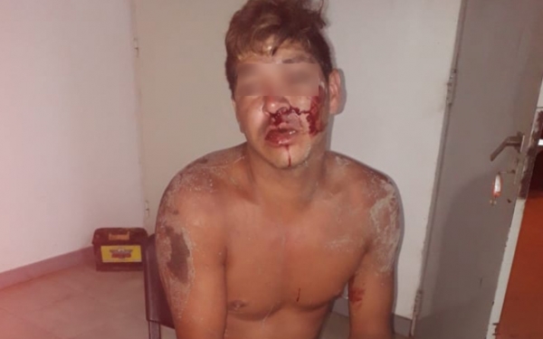 Fue golpeado al Comando Radioeléctrico, se arrepintió y no denunció a nadie