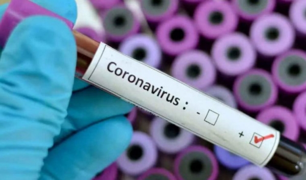 Se confirma el segundo caso de coronavirus en Baigorria