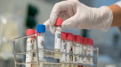 Baigorria se acerca al medio millar de infectados por coronavirus